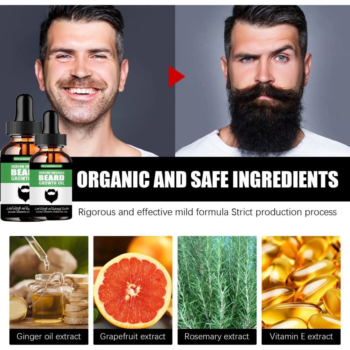 Huile de Croissance pour Barbe TRSTAY – Soin Naturel Contre la Perte de Cheveux