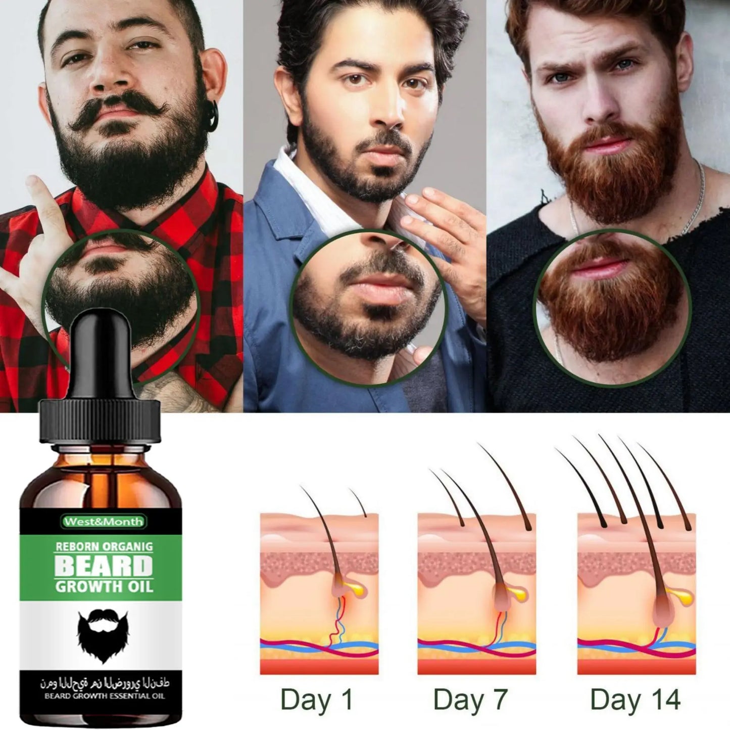 Huile de Croissance pour Barbe TRSTAY – Soin Naturel Contre la Perte de Cheveux